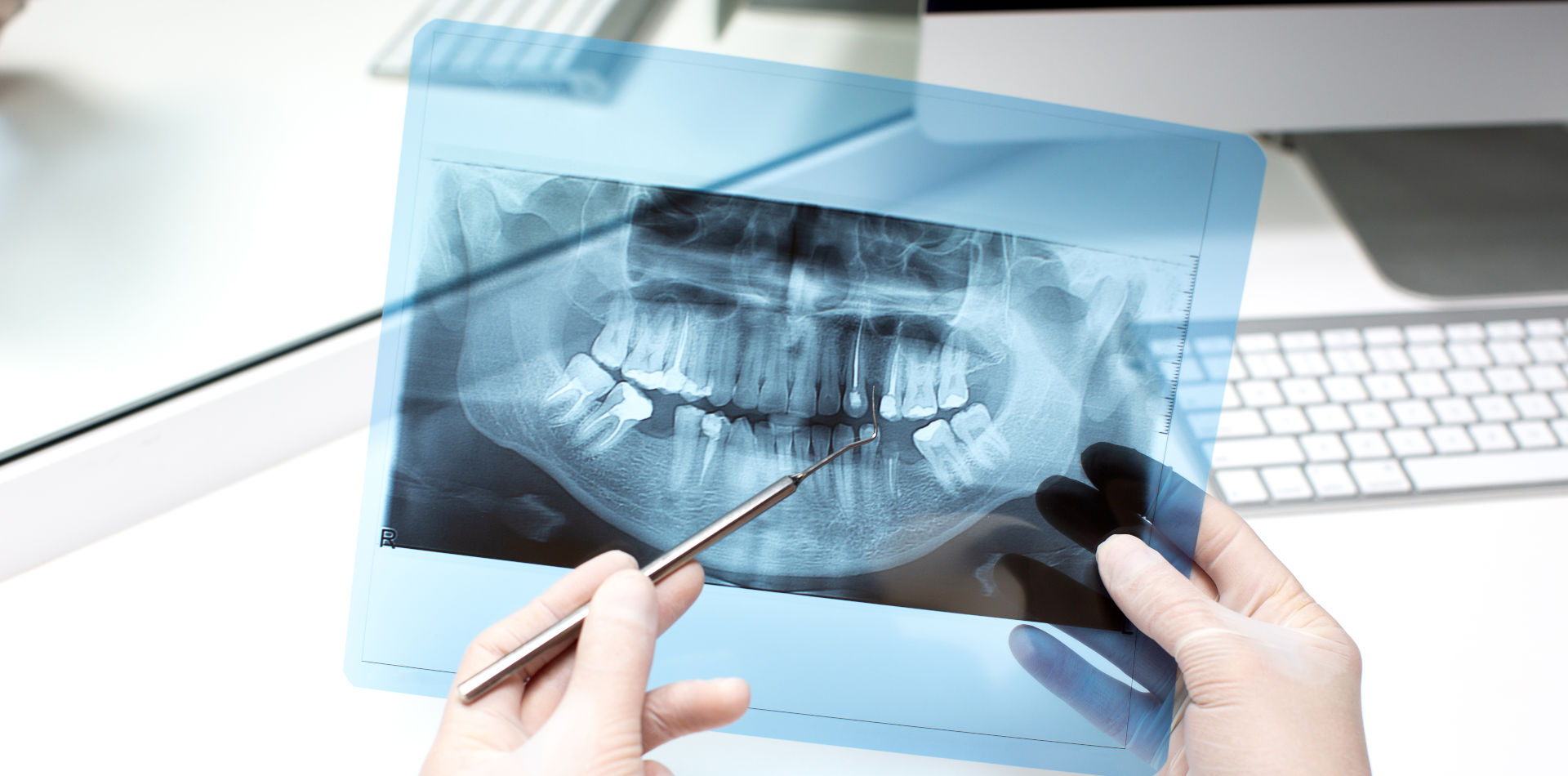 dentist analyzes x ray photo